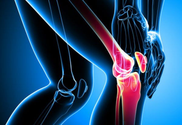 Arthrose : les bons réflexes